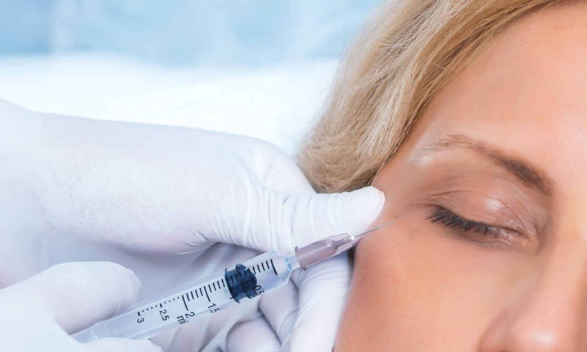 Umplerea cearcănelor cu acid hialuronic - când o recomand, pentru cine și ce alternative există