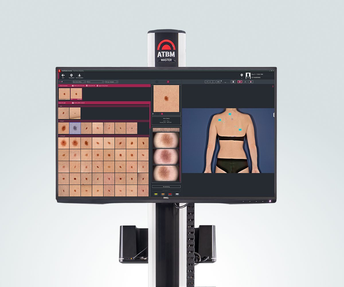 ATBM Master - FotoFinder