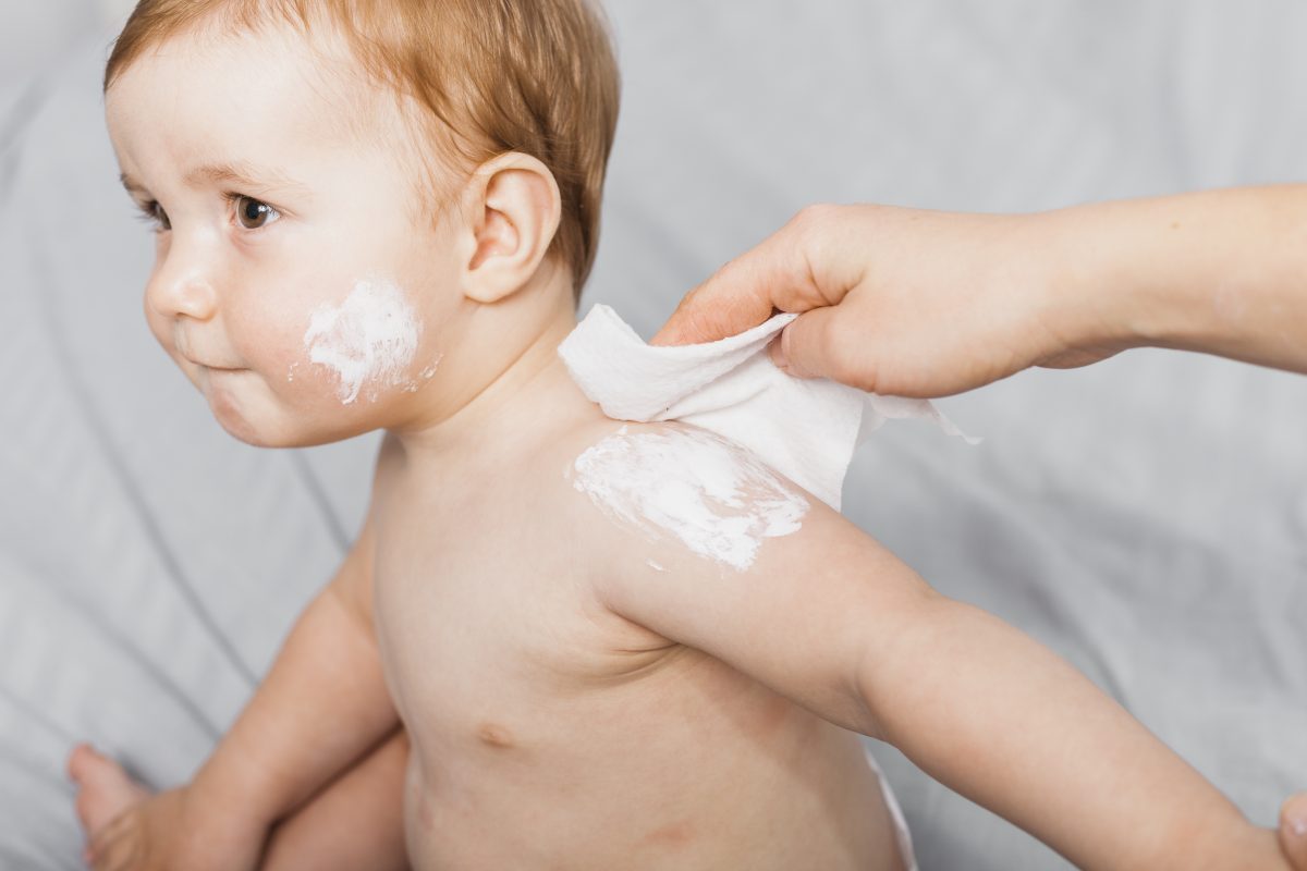Dermatologie pediatrică: cele mai frecvente probleme ale pielii la copii