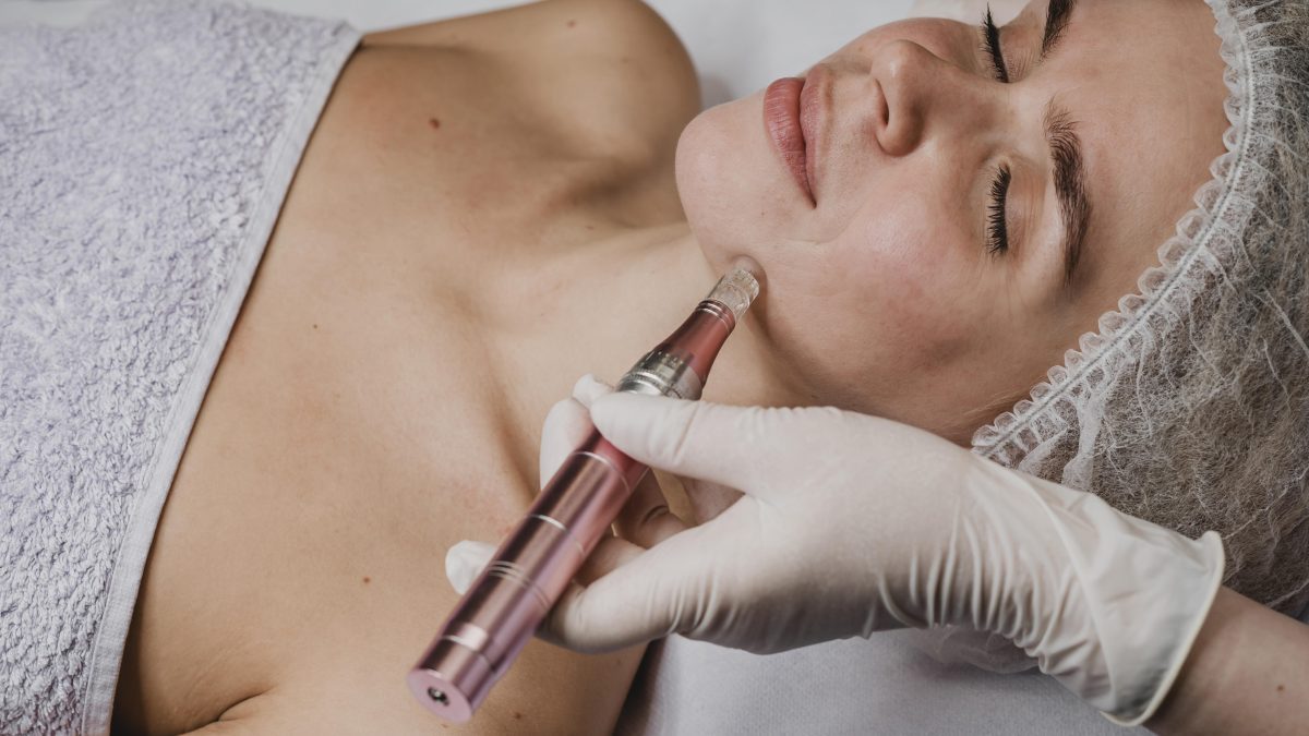 Microneedling cu NCTF 135 HA: revitalizare în profunzime